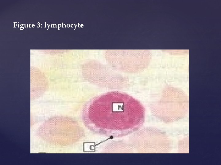 Figure 3: lymphocyte 