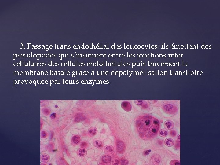 3. Passage trans endothélial des leucocytes: ils émettent des pseudopodes qui s’insinuent entre les