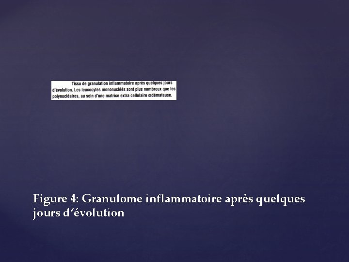 Figure 4: Granulome inflammatoire après quelques jours d’évolution 