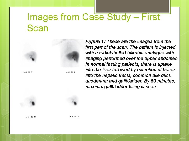 Images from Case Study – First Scan Figure 1: These are the images from