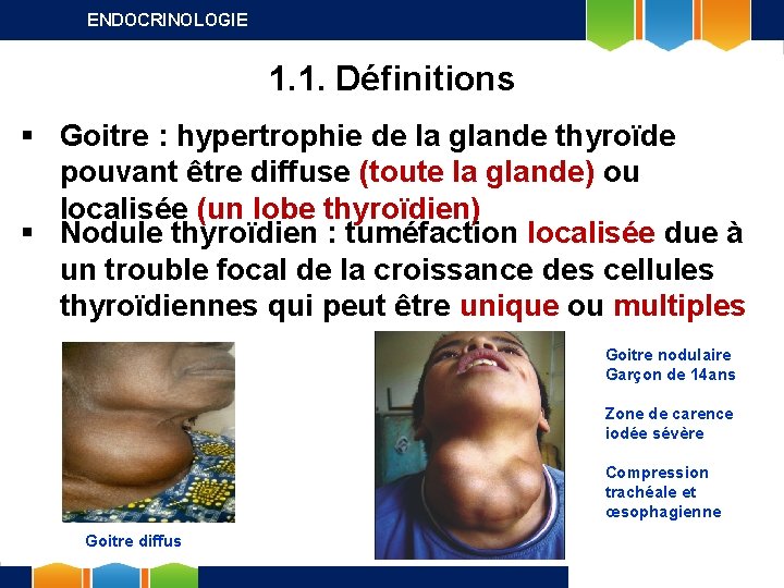 ENDOCRINOLOGIE 1. 1. Définitions § Goitre : hypertrophie de la glande thyroïde pouvant être