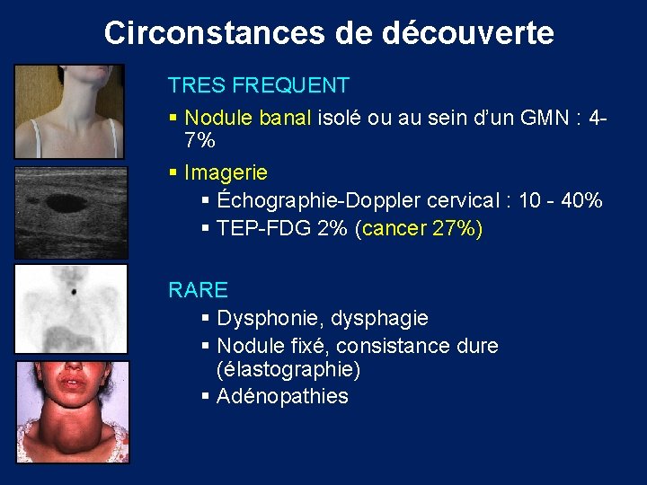 Circonstances de découverte TRES FREQUENT § Nodule banal isolé ou au sein d’un GMN