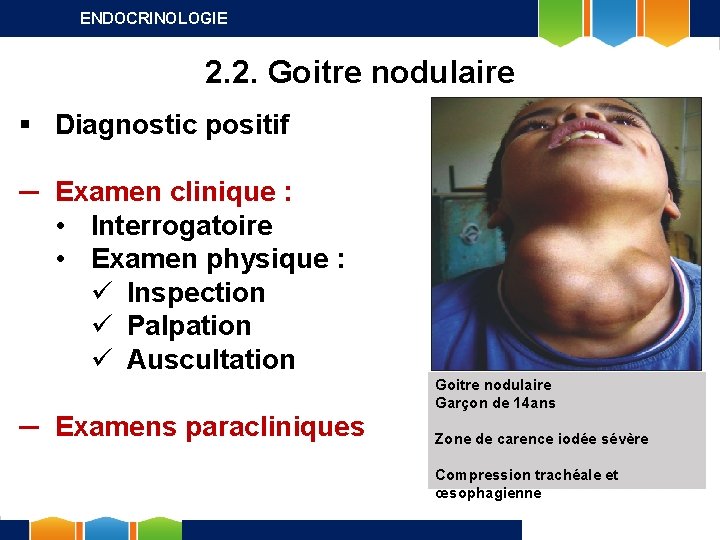 ENDOCRINOLOGIE 2. 2. Goitre nodulaire § Diagnostic positif ─ Examen clinique : • Interrogatoire