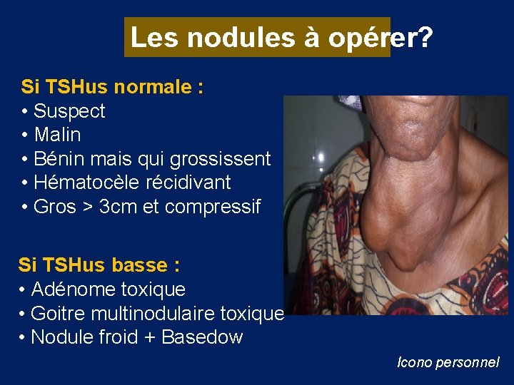 Les nodules à opérer? Si TSHus normale : • Suspect • Malin • Bénin