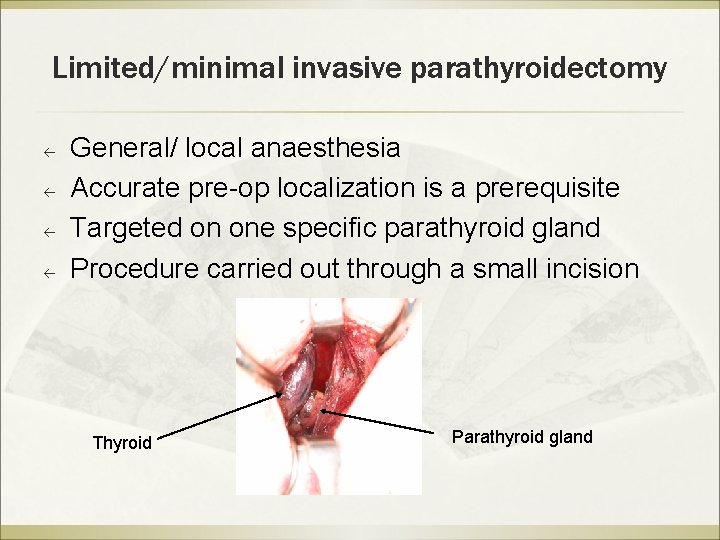 Limited/minimal invasive parathyroidectomy ß ß General/ local anaesthesia Accurate pre-op localization is a prerequisite