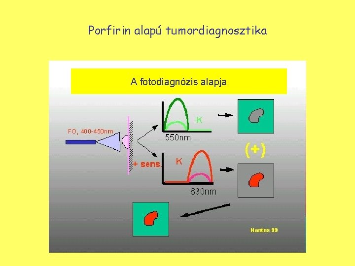 Porfirin alapú tumordiagnosztika A fotodiagnózis alapja 