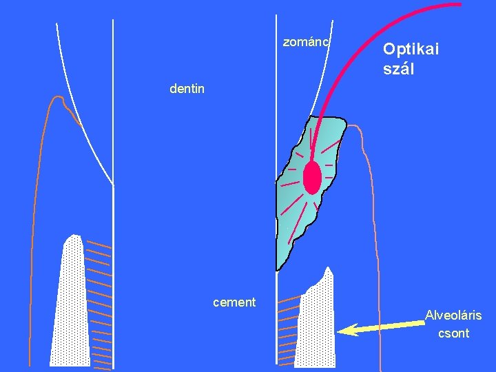 zománc Optikai szál dentin cement Alveoláris csont 