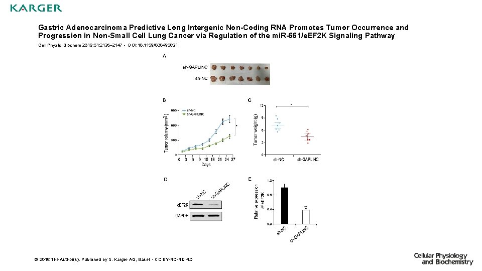 Gastric Adenocarcinoma Predictive Long Intergenic Non-Coding RNA Promotes Tumor Occurrence and Progression in Non-Small