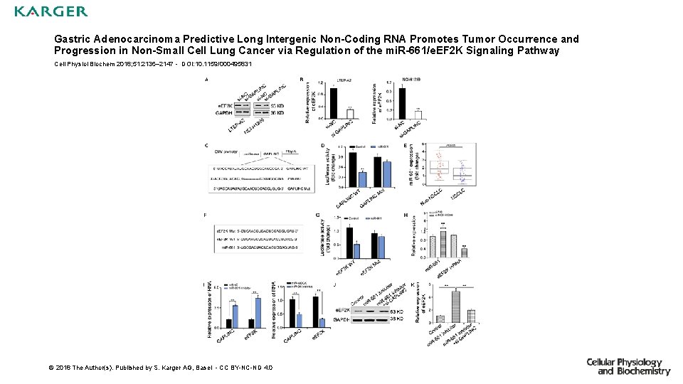 Gastric Adenocarcinoma Predictive Long Intergenic Non-Coding RNA Promotes Tumor Occurrence and Progression in Non-Small