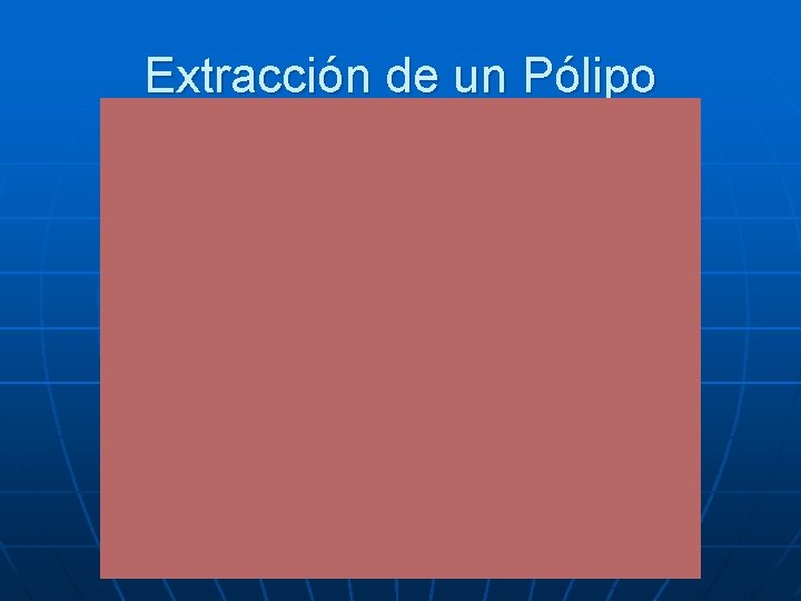 Extracción de un Pólipo 