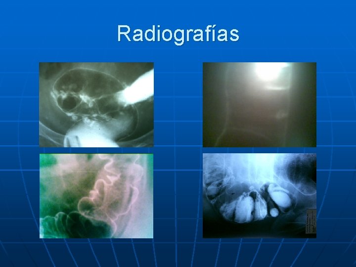 Radiografías 