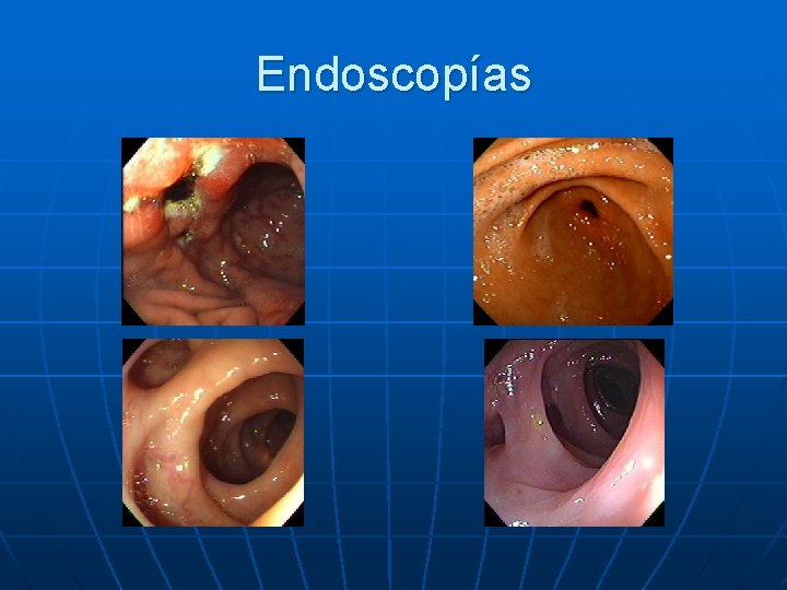 Endoscopías 