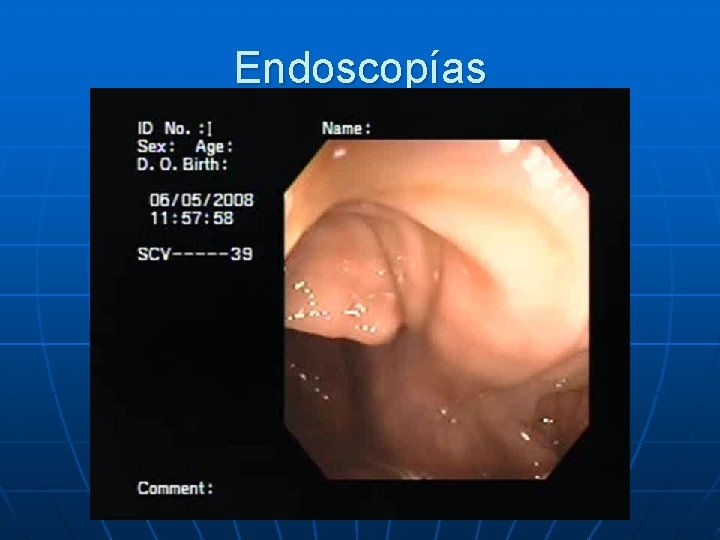 Endoscopías 