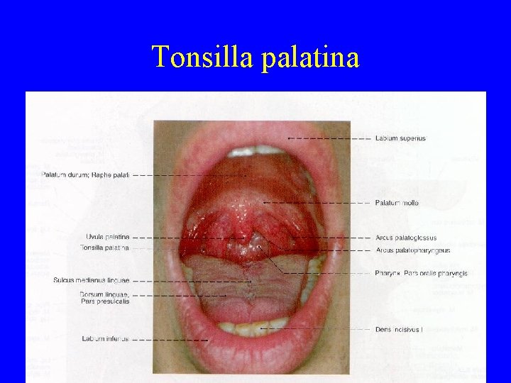 Tonsilla palatina 