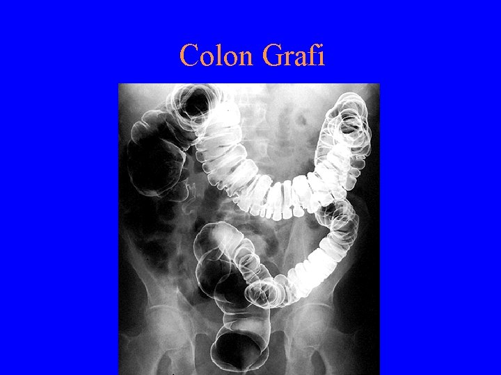 Colon Grafi 