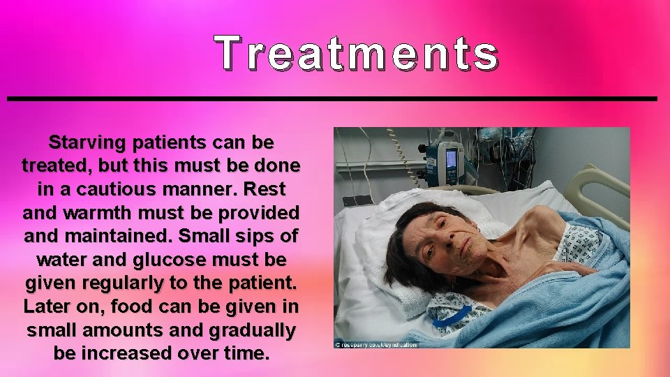 Treatments Starving patients can be treated, but this must be done in a cautious