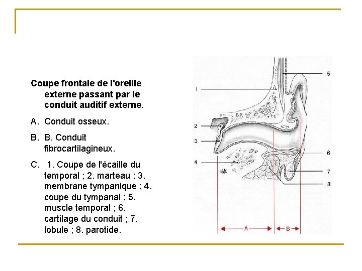 Coupe frontale de l'oreille externe passant par le conduit auditif externe. A. Conduit osseux.