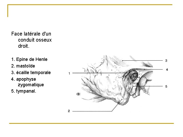 Face latérale d'un conduit osseux droit. 1. Epine de Henle 2. mastoïde 3. écaille