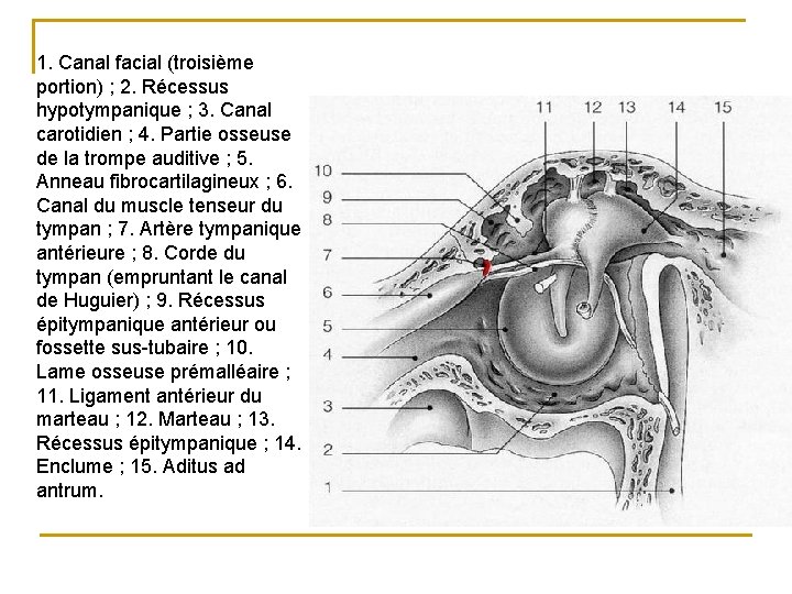 1. Canal facial (troisième portion) ; 2. Récessus hypotympanique ; 3. Canal carotidien ;