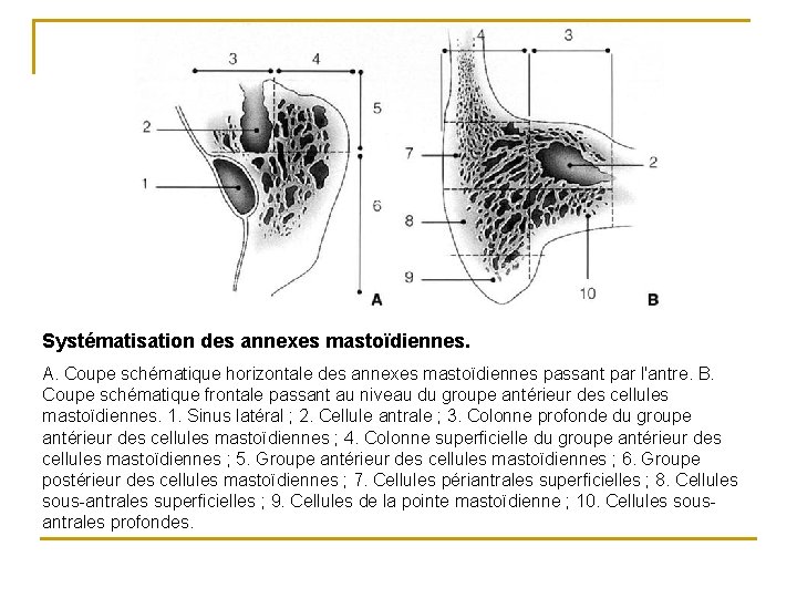 Systématisation des annexes mastoïdiennes. A. Coupe schématique horizontale des annexes mastoïdiennes passant par l'antre.