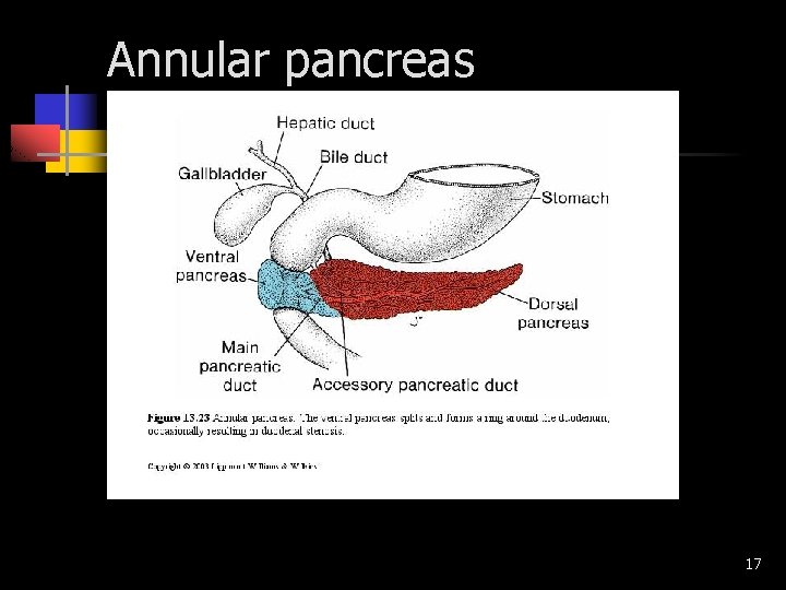 Neonatal intestinal obstruction General information Neonatal intestinal ...