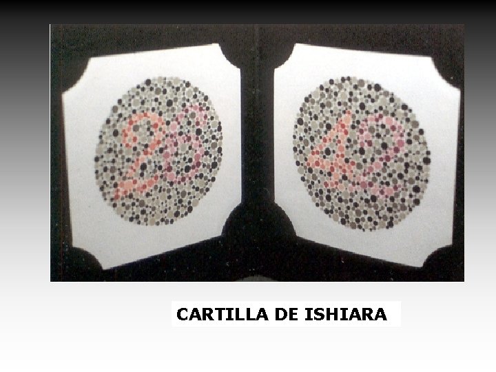 CARTILLA DE ISHIARA 