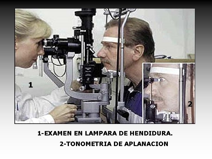 1 2 1 -EXAMEN EN LAMPARA DE HENDIDURA. 2 -TONOMETRIA DE APLANACION 