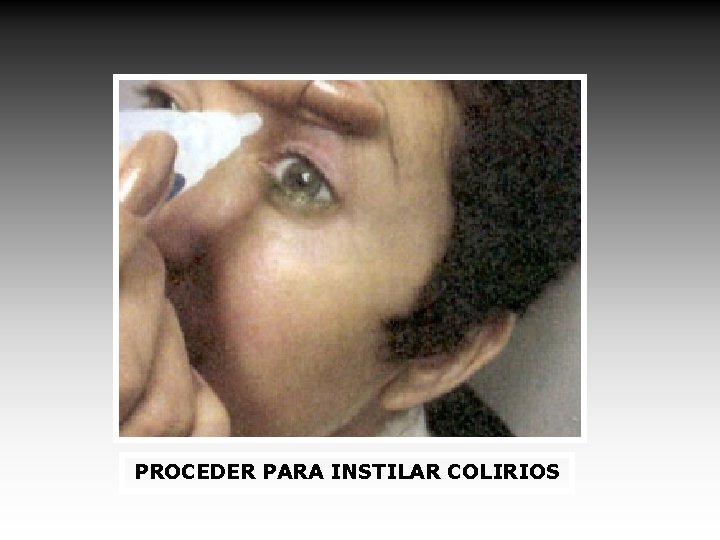 PROCEDER PARA INSTILAR COLIRIOS 