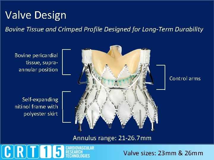 Valve Design Bovine Tissue and Crimped Profile Designed for Long-Term Durability Bovine pericardial tissue,