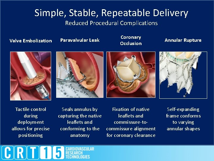 Simple, Stable, Repeatable Delivery Reduced Procedural Complications Valve Embolization Tactile control during deployment allows