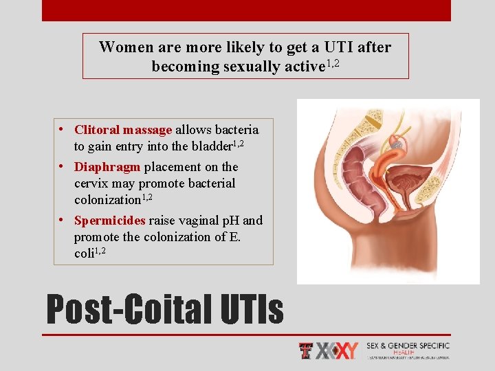 Women are more likely to get a UTI after becoming sexually active 1, 2