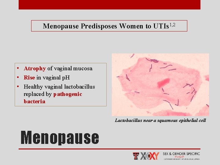 Menopause Predisposes Women to UTIs 1, 2 • Atrophy of vaginal mucosa • Rise