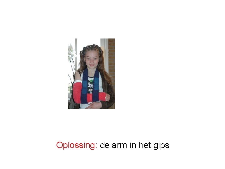 Oplossing: de arm in het gips 