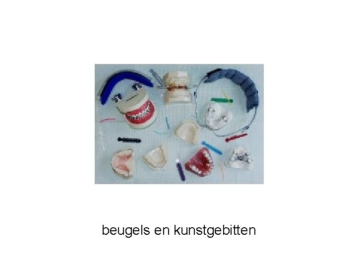 beugels en kunstgebitten 