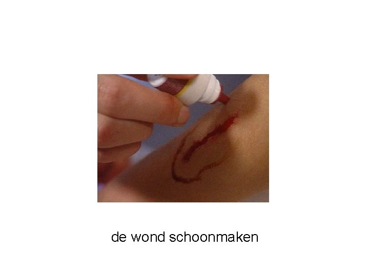 de wond schoonmaken 