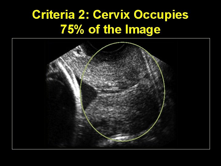 Criteria 2: Cervix Occupies 75% of the Image 