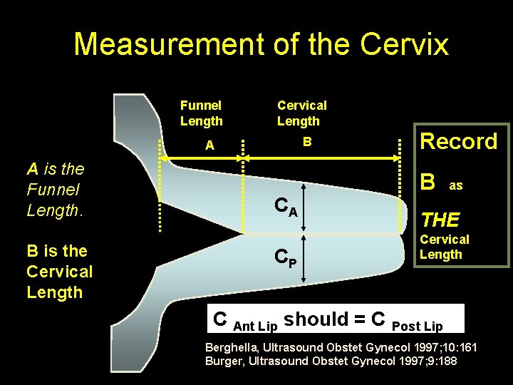Measurement of the Cervix Funnel Length Cervical Length B A A is the Funnel