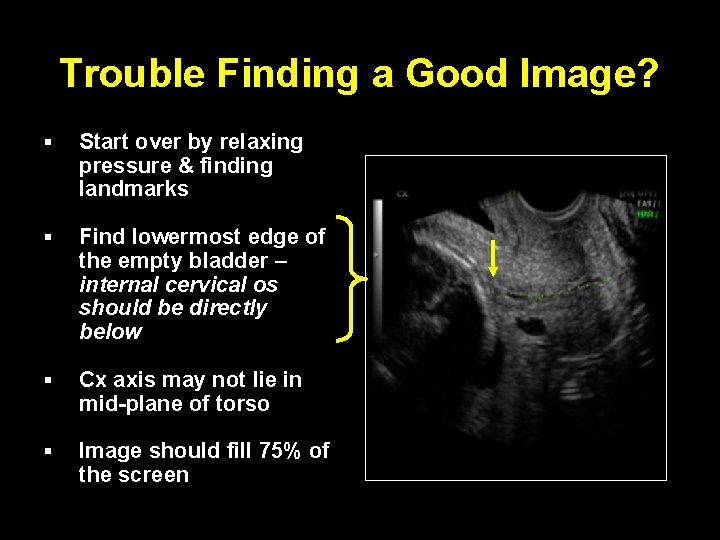 Trouble Finding a Good Image? § Start over by relaxing pressure & finding landmarks