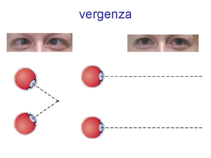 vergenza 