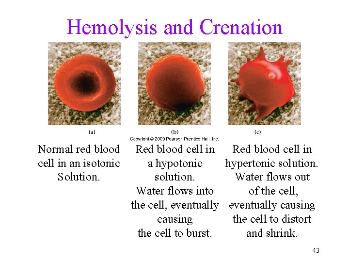 Hemolysis and Crenation Normal red blood cell in an isotonic Solution. Red blood cell