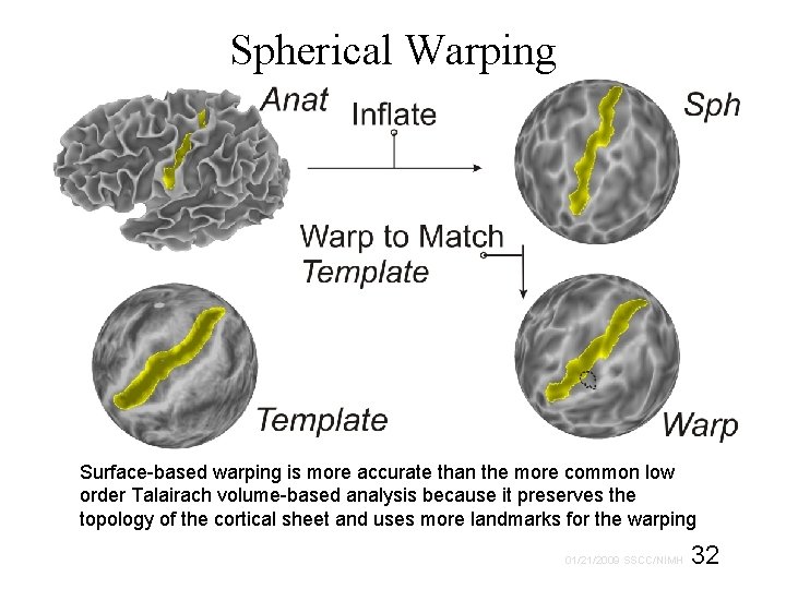 Spherical Warping Surface-based warping is more accurate than the more common low order Talairach