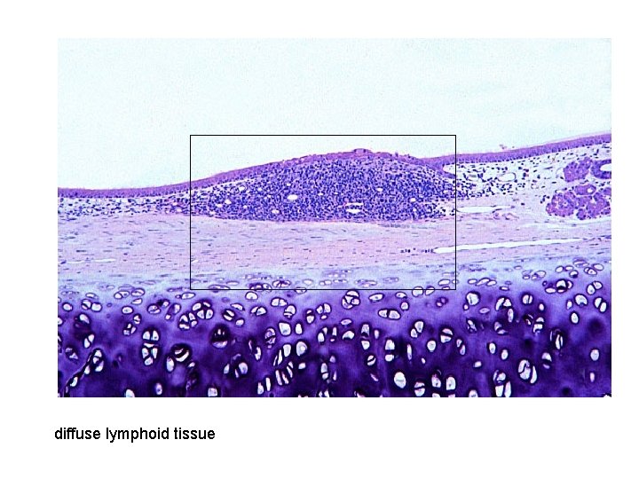 diffuse lymphoid tissue 