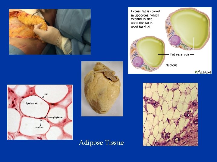 Adipose Tissue 