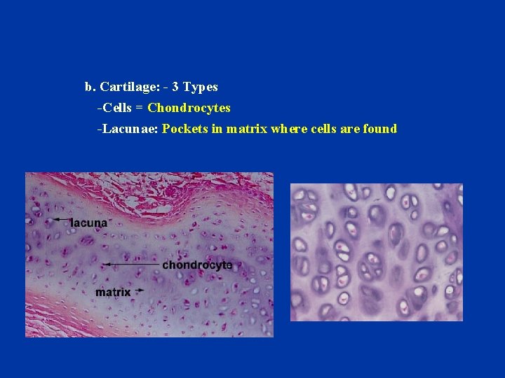 b. Cartilage: - 3 Types -Cells = Chondrocytes -Lacunae: Pockets in matrix where cells