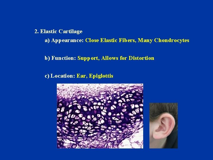 2. Elastic Cartilage a) Appearance: Close Elastic Fibers, Many Chondrocytes b) Function: Support, Allows