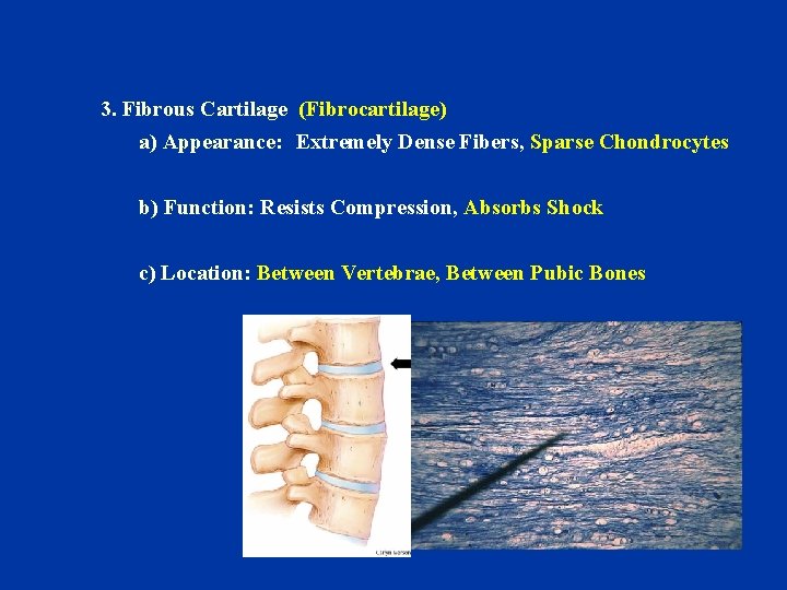 3. Fibrous Cartilage (Fibrocartilage) a) Appearance: Extremely Dense Fibers, Sparse Chondrocytes b) Function: Resists