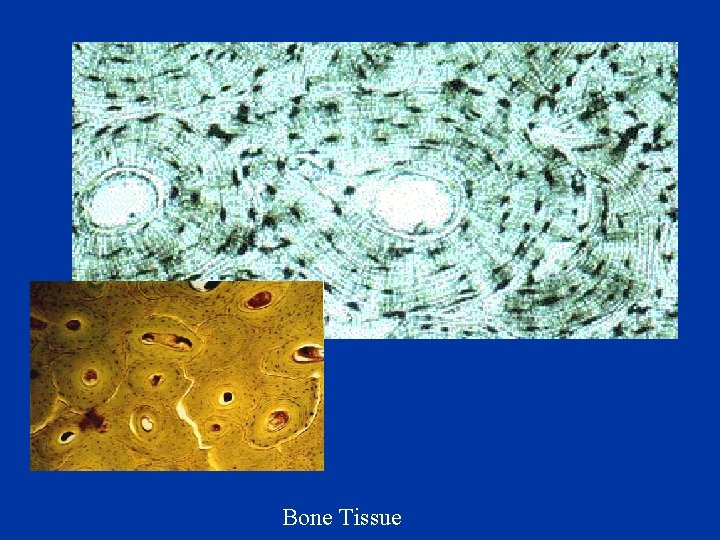 Bone Tissue 