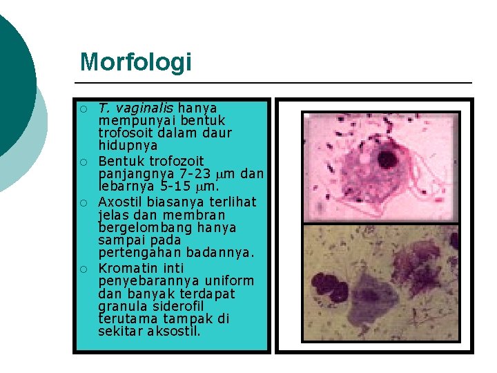 Morfologi ¡ ¡ T. vaginalis hanya mempunyai bentuk trofosoit dalam daur hidupnya Bentuk trofozoit