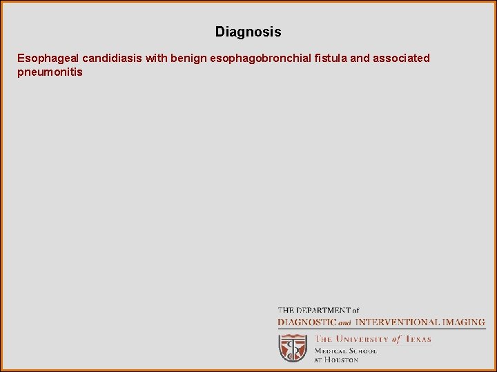 Diagnosis Esophageal candidiasis with benign esophagobronchial fistula and associated pneumonitis 