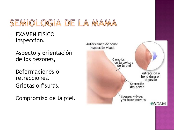  EXAMEN FISICO Inspección. Aspecto y orientación de los pezones, Deformaciones o retracciones. Grietas